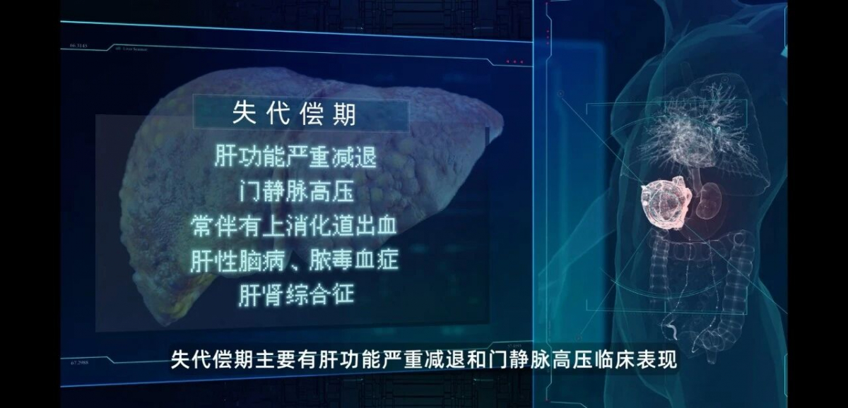 image-20251112090859-3