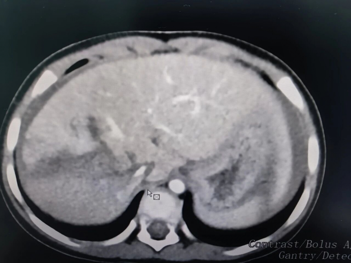 image-20251222100240-1