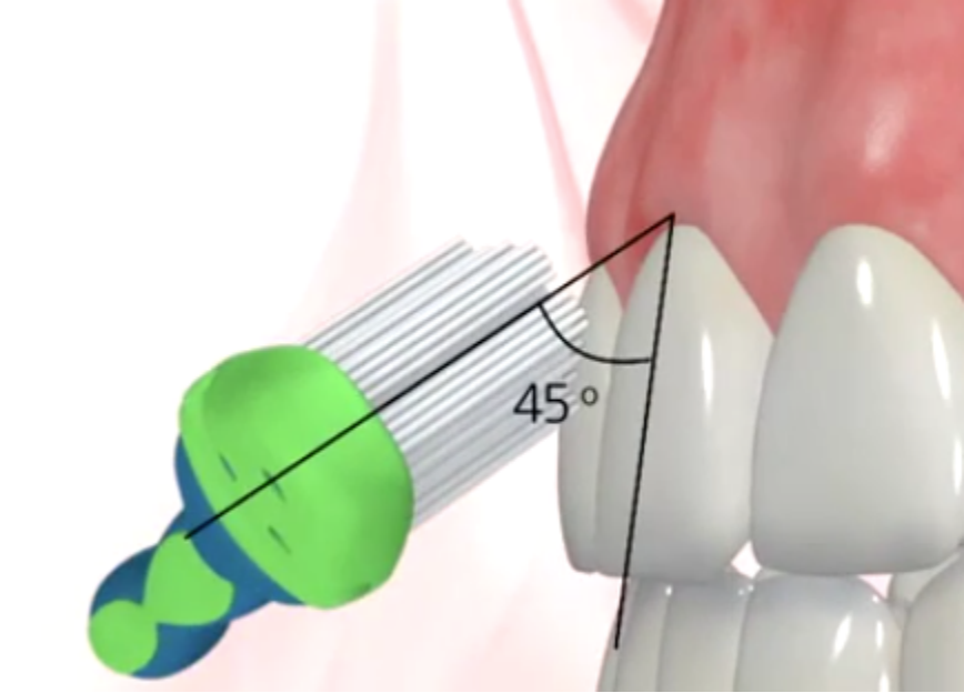 image-20260312083625-1