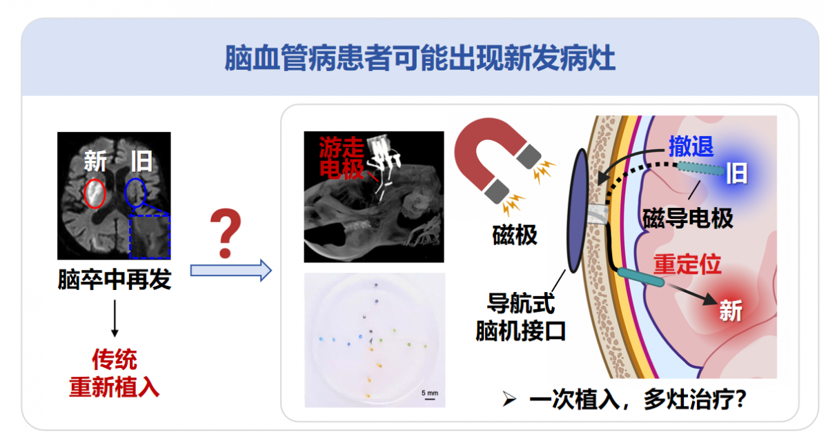 image-20260326112004-2