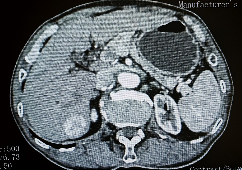 image-20260424114846-1