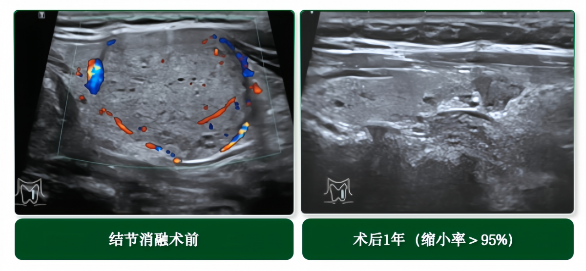 image-20260424144404-8