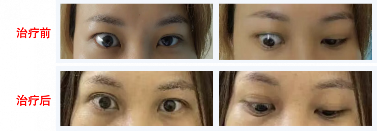 image-20260424144422-9