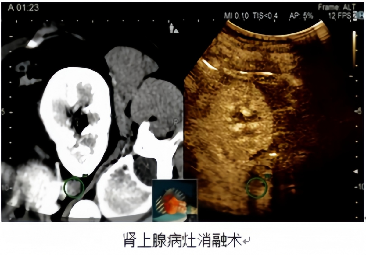 image-20260424144444-10